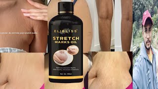 Elibliss Stretch Marks Oil  Honest Review [upl. by Epoh]