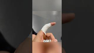 Sprained Finger here’s how to tape [upl. by Savell806]