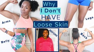 Why I Dont Have LOOSE SKIN After 100 Pound Weight Loss WITHOUT Surgery  TMI Skincare amp Nutrition [upl. by Dita]