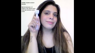 DERMA STAMPYAY OR NAY nonsponsoredreview honestreview hairgrowth microneedling skincare [upl. by Carrel672]