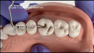 Class II cavity preparation for amalgam  maxillary molar 26  Preclinical Operative  Arabic عربي [upl. by Eitak]