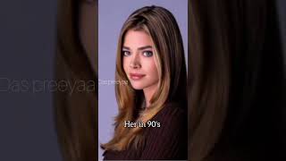 Denise Richards flaunts her infamous upside down jacket from ‘RHOBH’ shorts [upl. by Ronel]