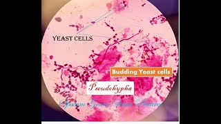 Yeast cell under microscope Sputum gram stain Yeast cells in sputum [upl. by Eirrehc838]