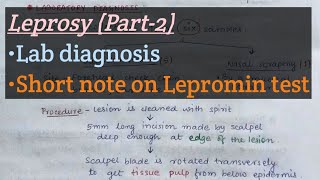 Leprosy Part2  Lab diagnosis of leprosy  Lepromin test short note  mformicrobiology108 [upl. by Thebault]