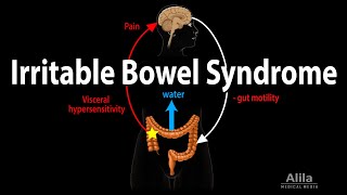 Irritable Bowel Syndrome Pathophysiology Symptoms Causes Diagnosis and Treatment Animation [upl. by Affrica]