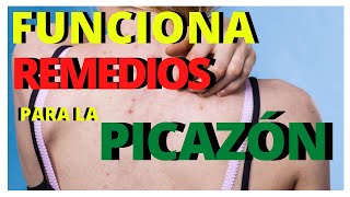 COMO QUITAR la PICAZON en el CUERPO en MINUTOS con ALGO NATURAL REMEDIOS CASEROS para LA COMEZÓN [upl. by Villada]