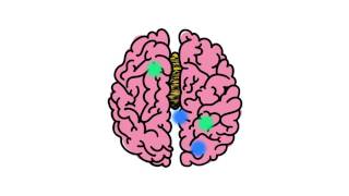 Understanding Disorders of the Corpus Callosum Animated Video by NODCC [upl. by Marie]