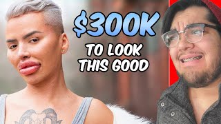 He Spent 300k To Look Good But Is It Worth It [upl. by Cannon]