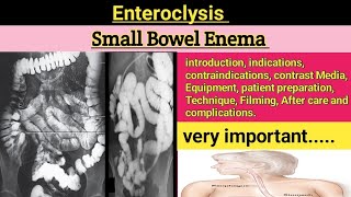 Small Bowel Enema  Enteroclysis  small bowel enema procedure  Barium Enema enteroclysis 2024 [upl. by Enelcaj]