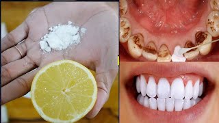 Achieve Natural Teeth Whitening And Remove Tartar [upl. by Imoyik]