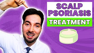 Scalp Psoriasis Removal and Best Treatment At Home [upl. by Yoho]