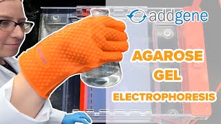 Agarose Gel Electrophoresis [upl. by Liuqa]