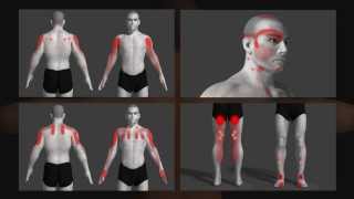 trigger point uitleg animatie Dutch [upl. by Eecyal]