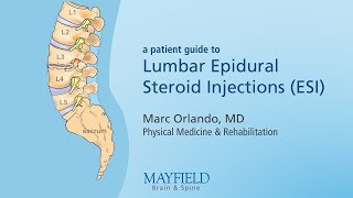 Lumbar Epidural Steroid Injections [upl. by Donovan]