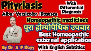 Pityriasis  सेहुआ  सफेद दाग  फीका दाग  Best Homeopathic Medicines [upl. by Metts]