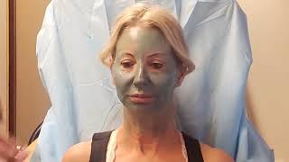 Roxanne Dorty RN Demonstrates Obagi Blue Peel [upl. by Whitehurst]