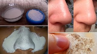 How to Remove Blackheads Naturally [upl. by Rudich]