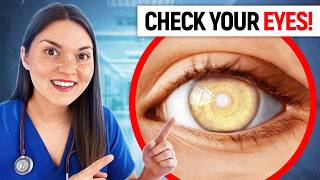 What Your EYES Say About your HEALTH Doctor Explains [upl. by Onibas]