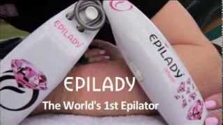 Epilady  before and after [upl. by Notaes]