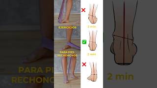 Top 3 ejercicios para el pie caído shorts [upl. by Yelhsa]