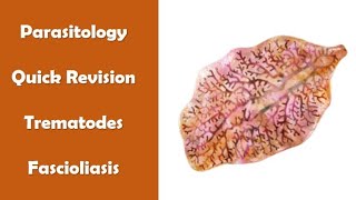 quick revision  Fascioliasis  parasitology  ID2 module Adham saleh [upl. by Adian]