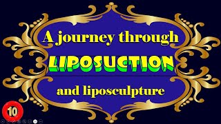 A journey through liposuction and liposculpture Part 1010 and the last [upl. by Bust]