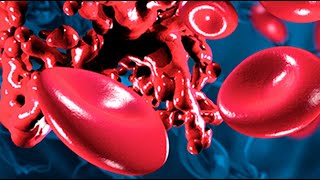 Appropriate Anticoagulant Therapy in Patients at Risk for Deep Vein Thrombosis amp Pulmonary Embolism [upl. by Shipley314]