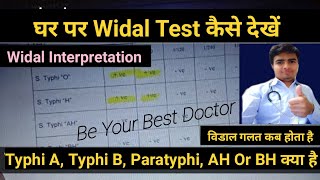 Widal Test In Hindi  विडाल टेस्ट  Widal Test Report Reading In Hindi  Typhoid Fever Test [upl. by Evin]