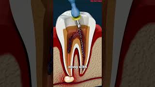 What Is A Root Canal 😳facts shorts youtubeshortsshortsvideo reels [upl. by Niloc]