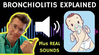 Doctor explains Bronchiolitis RSV with example of REAL SOUNDS  Respiratory syncytial virus [upl. by Valentino]