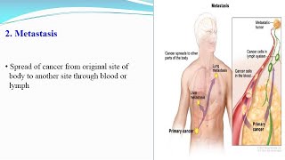 Characteristics of Cancer Cells [upl. by Ally]