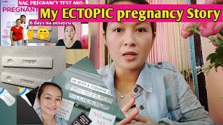 My ECTOPIC pregnancy Story Hasset G vlogs [upl. by Oirramed]