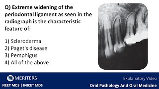 NEET MDS  INICET  OPM  Skin And Vesiculobullous Lesions  Explanatory Video  MERITERS [upl. by Barcellona]