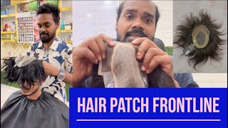 Frontless hair patch Frontline hair patch Premium quality hair patchhairpatchinkolkata [upl. by Eneliak57]