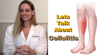 CELLULITIS Everything You Need To Know Symptoms Cause Risk Factors Treatment Prevention [upl. by Berlyn578]