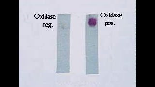 Oxidase Test [upl. by Ocirred]