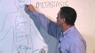 How Cancer Spreads Metastasis  Michael Henry PhD [upl. by Patnode]