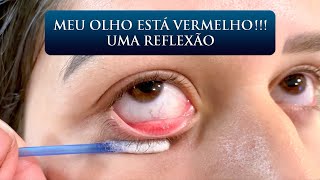 MEU OLHO ESTÁ VERMELHO UMA REFLEXÃO [upl. by Nylarak]