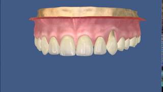 DioDent  odontoiatria e medicina estetica [upl. by Christis]