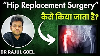 Hip Replacement Surgery  Dr Rajul Goel  Hip Replacement in Kurukshetra  THR Kurukshetra [upl. by Auehsoj82]