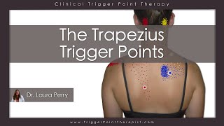 The Trapezius Trigger Points [upl. by Arym]