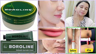 Top 10 uses of BOROLINE for skincare ll 100 Result ll Amazing Benefits of BOROLINE l BOROLINE hacks [upl. by Aynuat]