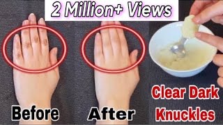 Do This Every Night For 7 Days To Lighten Dark Knuckles And Brighten Hands amp Feet  Faiqa Studio [upl. by Cohby]