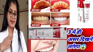 Yayashi Sp4 Toothpaste Honest Review  Yayashi Sp4 toothpaste benefits uses review in hindi [upl. by Lemieux350]