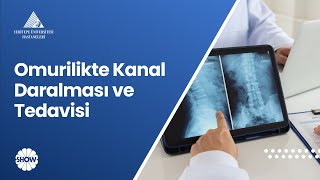 Omurilikte Kanal Daralması ve Tedavisi  Prof Dr Ahmet Hilmi Kaya [upl. by Atinav125]