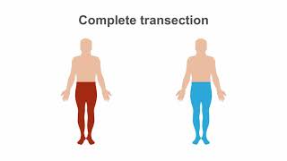 Spinal Cord Syndromes Clinical Recognition amp Anatomy Review [upl. by Yelsha]