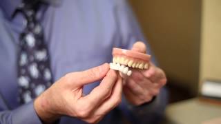 How to Whiten Yellowed False Teeth  Dental Hygiene [upl. by Ramma]