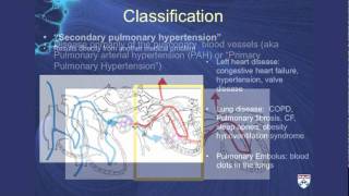 Pulmonary Hypertension A challenging cause of shortness of breath [upl. by Doble163]