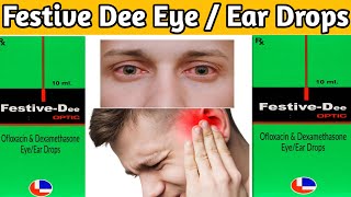 festive dee  festive dee optic eyeear drops ofloxacin dexamethasone eye ear drops [upl. by Darbee675]