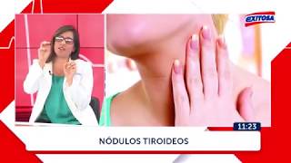 NÓDULOS TIROIDEOS  ANA BURGA CIRUJANA DE CABEZA Y CUELLO HEVES [upl. by Natrav]